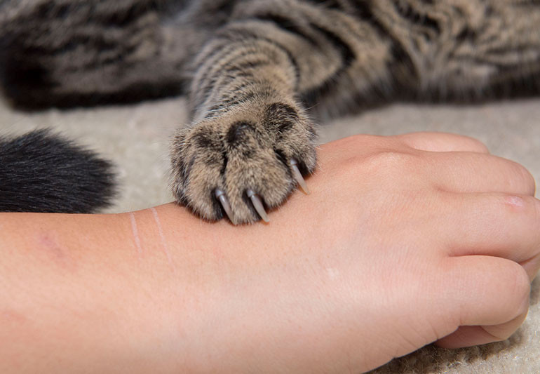 Arañazos y mordeduras de gatos, ¿qué tan riesgosos son?